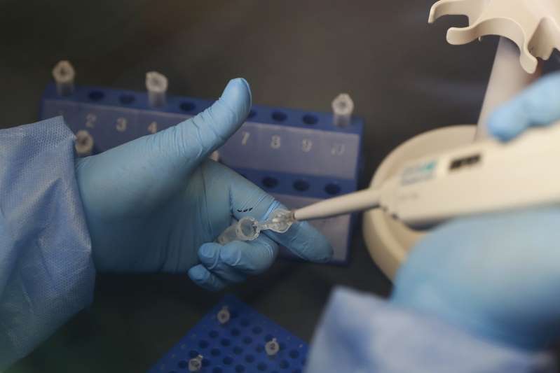 Laboratorio peruano desiste de elaborar vacunas contra covid-19 por cansancio