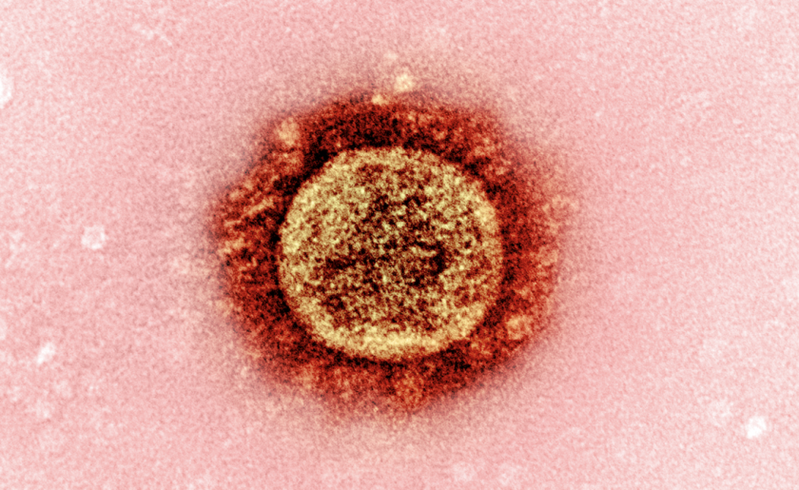 Estudio muestra que la suerte es esencial para el éxito de cualquier variante de coronavirus