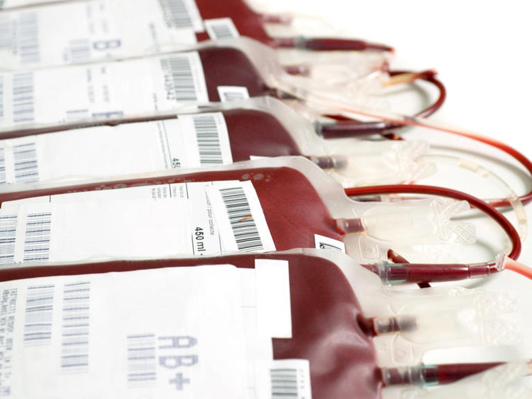 Encuentran microplásticos en sangre humana por primera vez en un estudio “extremadamente preocupante”